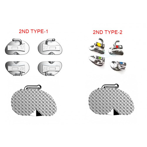 2ND Molar Tube 25x4 100 Pcs (Type-1 /Type-2)